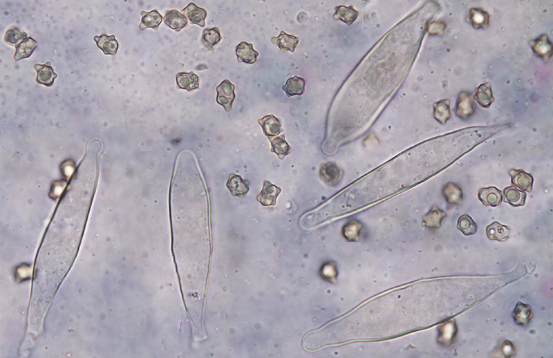 Inocybe subcarpta mikro